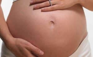 Estrias durante a gestação e no pós-parto 4