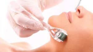 Microagulhamento: o procedimento estético que ameniza manchas e renova a pele 1