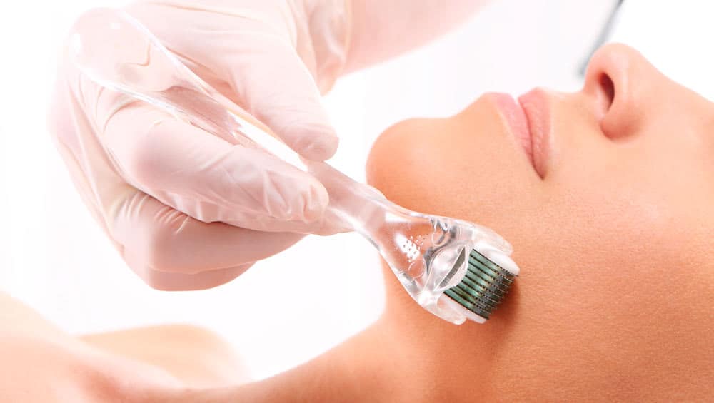 Microagulhamento: o procedimento estético que ameniza manchas e renova a pele 1