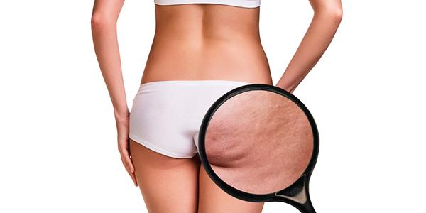 Disfunções Estéticas 6