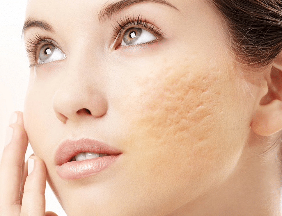 Disfunções Estéticas 2