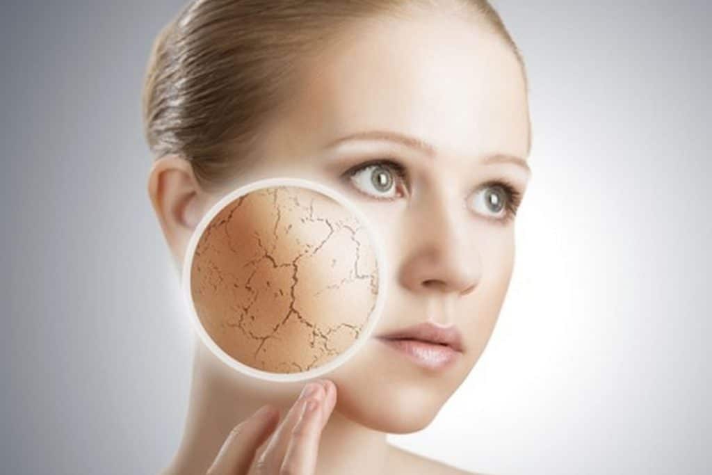 Como o estresse afeta a sua pele? 1