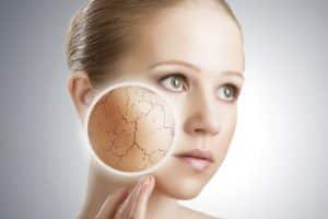 Como o estresse afeta a sua pele? 4