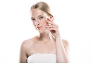 Melasma - Saúde a flor da pele 1